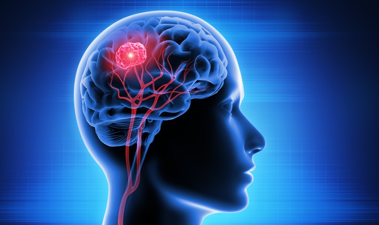 Brain Cancer Division