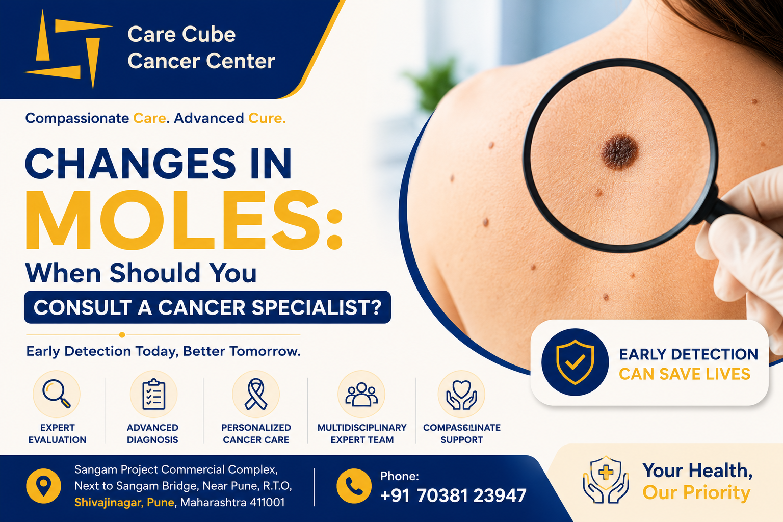 Changes in Moles: When Should You Consult a Cancer Specialist?